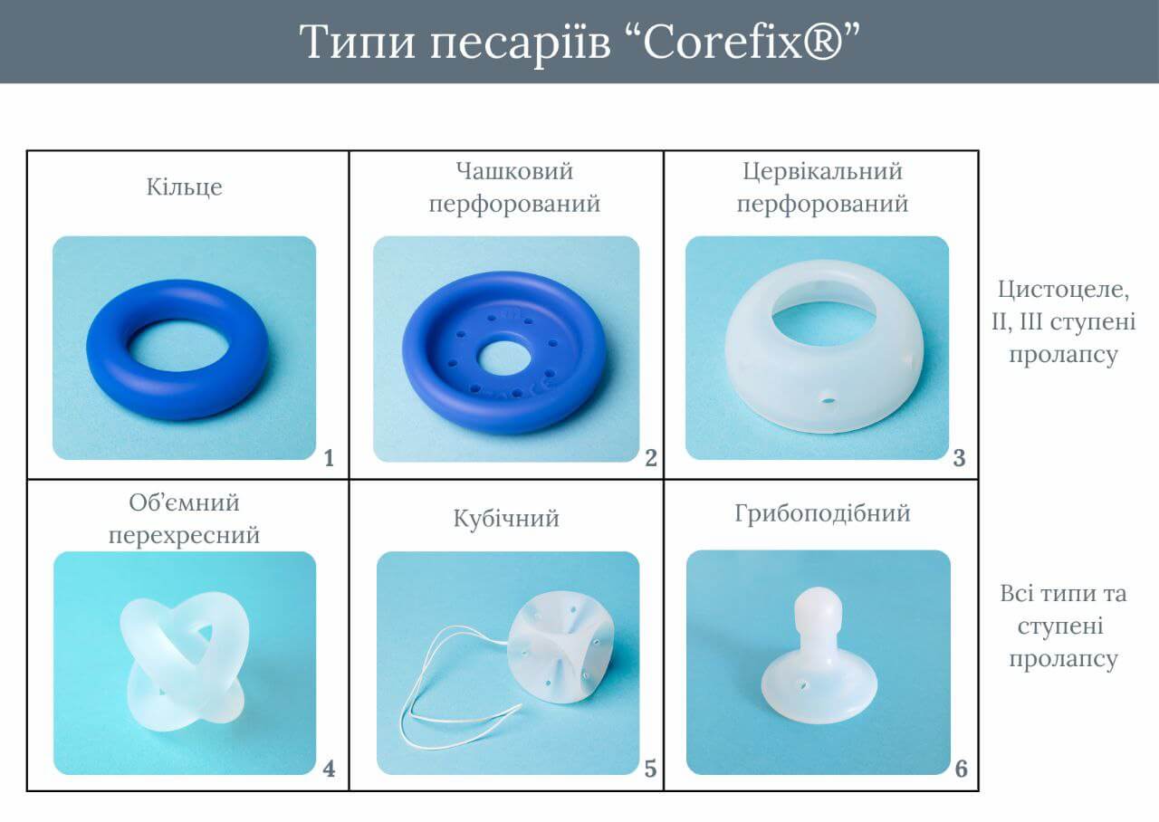песарії при пролапсі